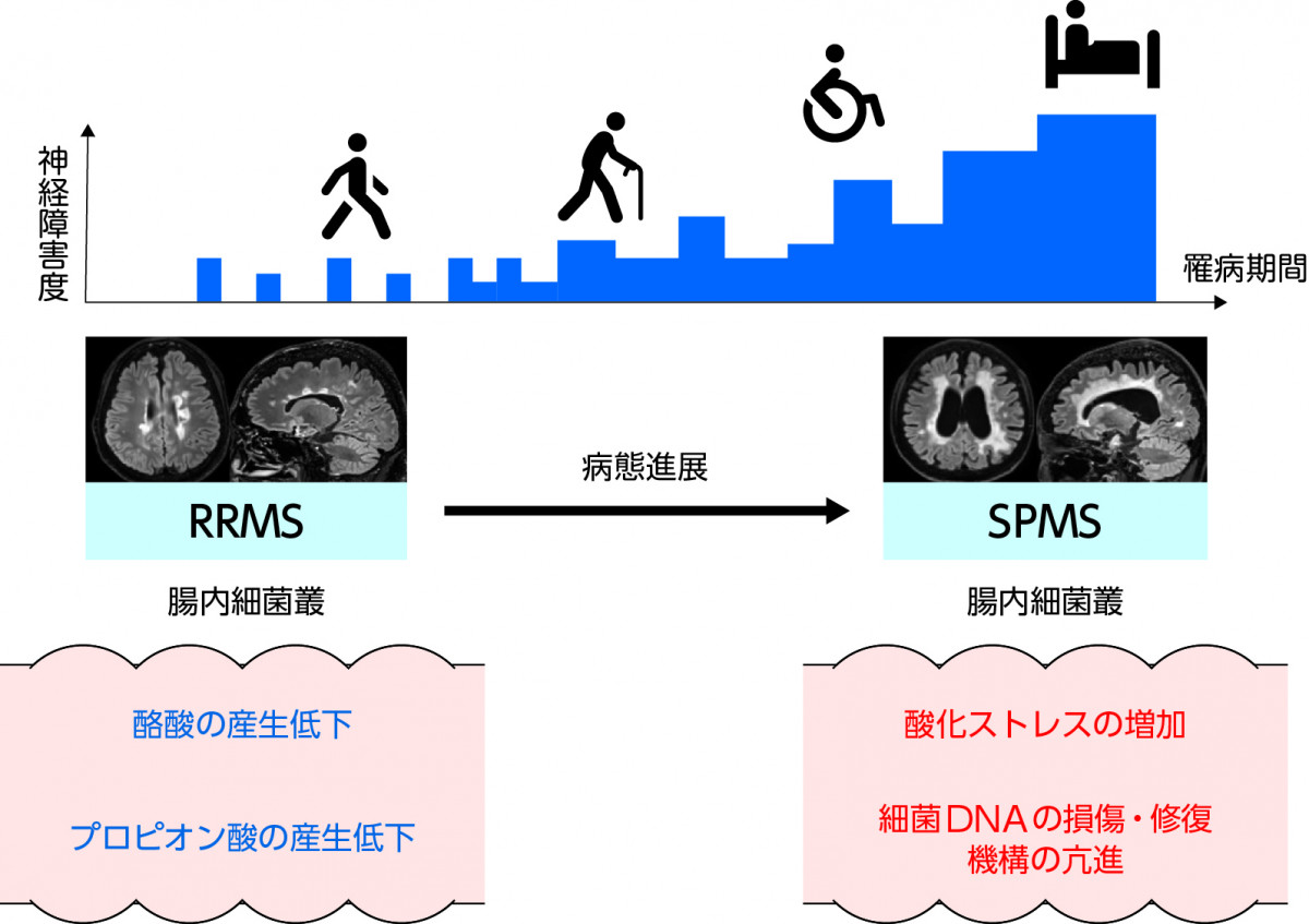 多発性硬化症への臨床活用：多発性硬化症の難治化と関連する異型